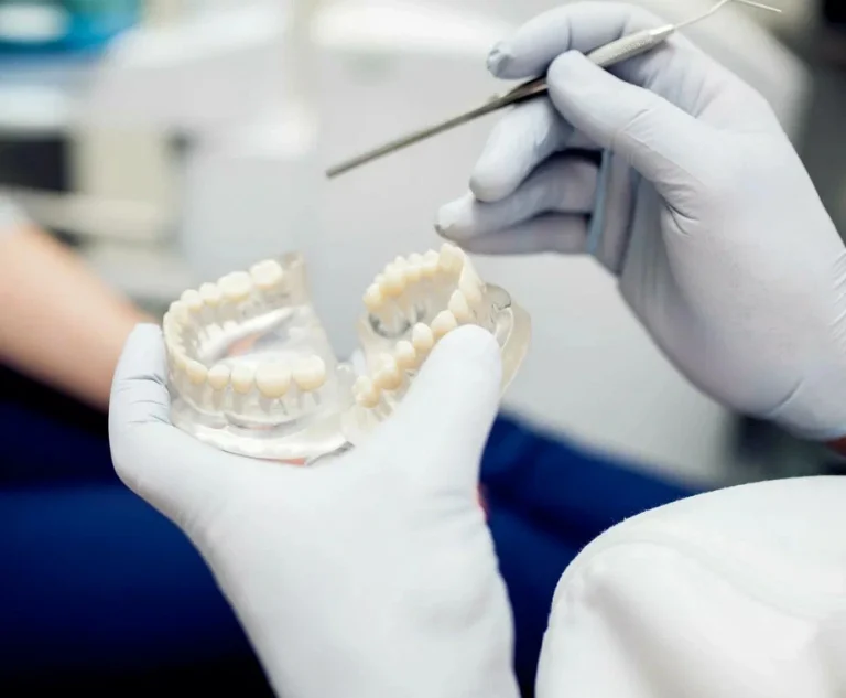 Dental Crowns & Bridges