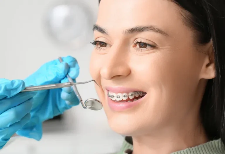 Braces & Aligners